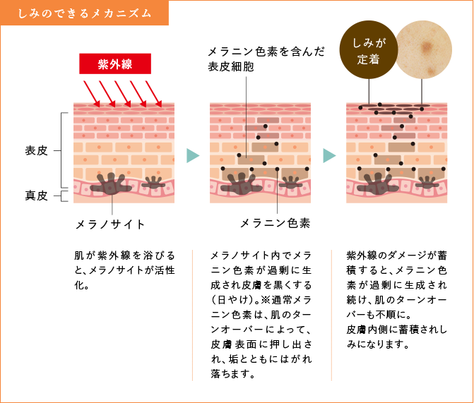 しみのできるメカニズム