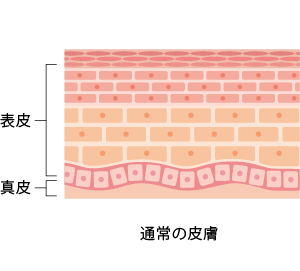 通常の皮膚