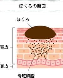 いぼ 水いぼ くみこクリニック北山院